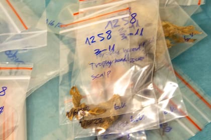 Diversas muestras tomadas de las momias