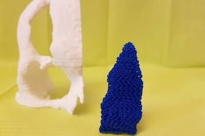 Dos ejemplos de prótesis hechas con impresoras 3D que ayudan al hueso a regenerarse tomando la forma adecuada, y que luego se disuelven en el cuerpo