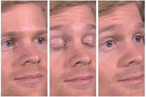 Drew Scanlon es el protagonista del meme "hombre parpadeante"