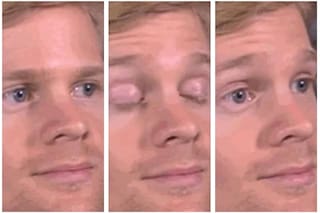 Así está hoy el hombre del famoso meme del parpadeo: se llama Drew Scanlon y vive en California