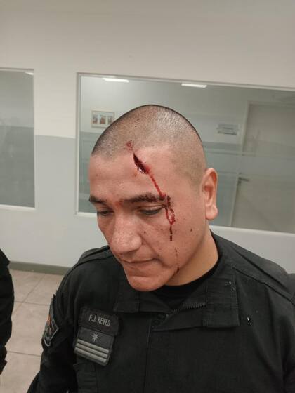 Durante incidentes en la villa 15, fue herido el oficial mayor Fernando Reyes