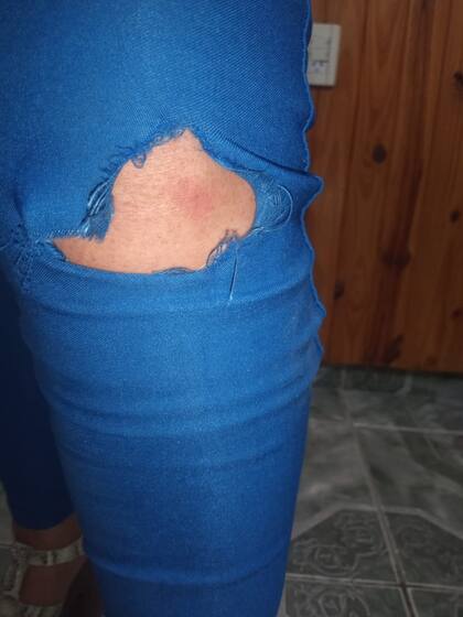 Durante la reunión, Natacha sufrió daños en su ropa