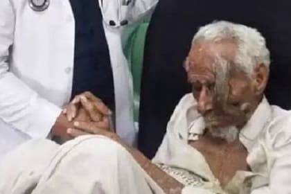 Durante sus últimos días, el "hombre cabra" había acudido a un médico para que le saquen los cuernos