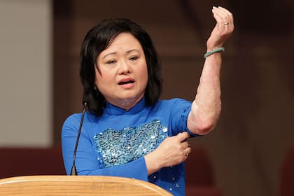 Durante un discurso en una iglesia, Kim Phuc mostró las marcas que quedaron en su piel tras las quemaduras que sufrió en 1972