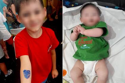 Dylan tiene 5 años y vive en Confluencia, Neuquén; fue diagnosticado con alergias alimentarias múltiples, entre ellas APLV. A la derecha se lo ve de bebé, con el rostro brotado por su enfermedad