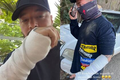 El cantante sufrió un accidente mientras andaba en cuatriciclo