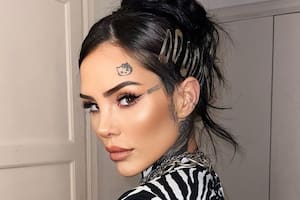 Cande Tinelli sufrió un accidente durante la grabación del reality familiar y debió ser operada de urgencia