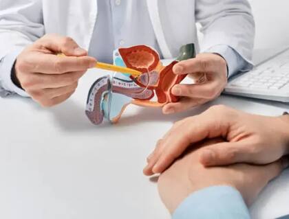 El achiote favorece a las vías urinarias