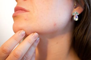 El factor silencioso que puede afectar la salud de la piel por el uso de dispositivos móviles