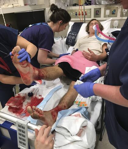 El adolescente Sam Kanizay recibe asistencia médica en un hospital tras, según afirmó, recibir mordiscos de "diminutas criaturas marinas" en la bahía local, en Melbourne