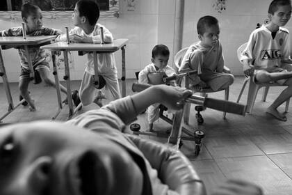 El agente naranja provocó serios daños a la salud de los afectados y problemas en el desarrollo fetal, como malformaciones, de muchos niños