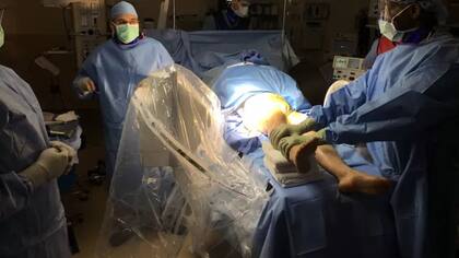 El alargamiento de piernas es una operación compleja que implica muchos meses de recuperación