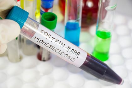 El análisis de sangre para determinar si un persona está infectada con mononucleosus es probable que arroje un resultado falso negativo durante la primera semana de la enfermedad; por esta razón, es importante repetir la extracción de sangre si los síntomas persisten