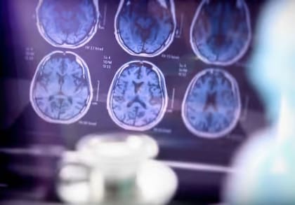 El análisis proporcionaron toda la evidencia del daño que ocasiona la enfermedad