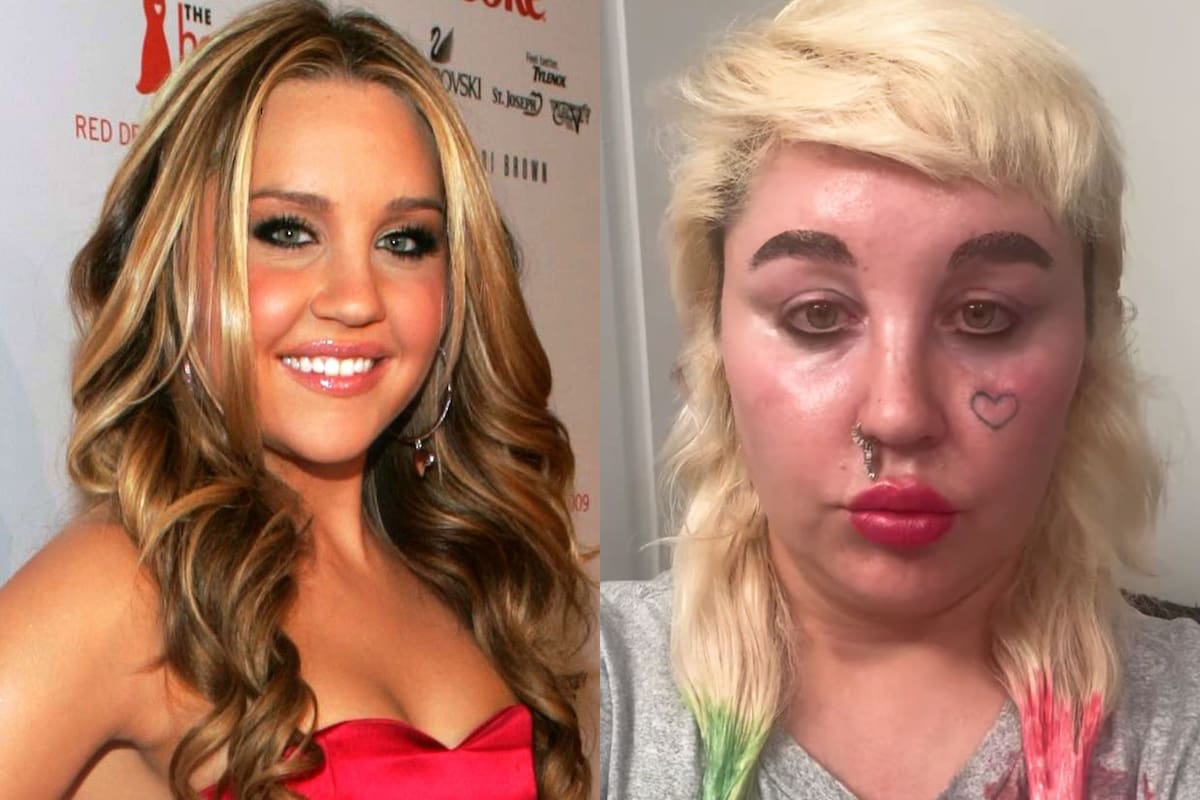 De um ícone juvenil da Nickelodeon a uma vida de mudanças físicas extremas e drásticas. como está Amanda Bynes hoje?