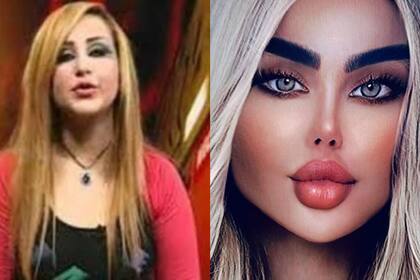 El antes y después de Dalia Naeem, la actriz se realizó 43 cirugías para parecerse a Barbie