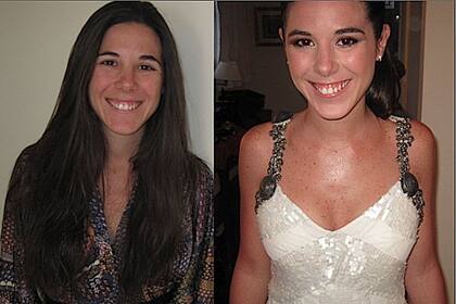 El antes y el después