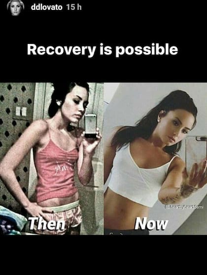 El antes y el después de Demi Lovato