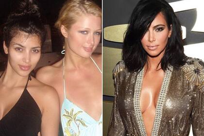 El antes y el después de Kim Kardashian