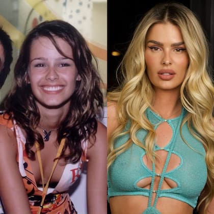 El antes y el después de Yasmin Brunet. Gracias al procedimiento Nefertiti estilizó su rostro