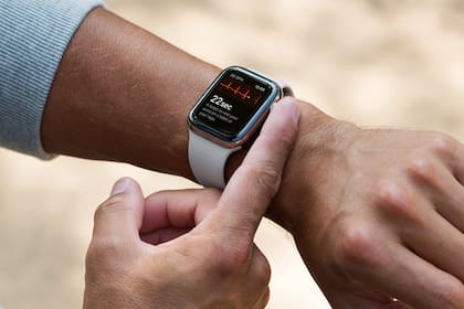 El Apple Watch le marcó al jubilado que tenía una frecuencia cardíaca de 130 veces por minuto