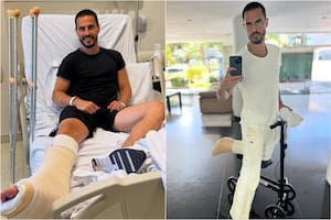 Juan Marconi mostró la impresionante cicatriz que le quedó tras la operación del tendón de Aquiles