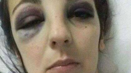 El arquero de un equipo del interior de Córdoba quedó detenido tras una feroz golpiza a su novia de 26 años