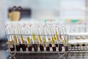 El ataque se produjo el 20 de noviembre pasado