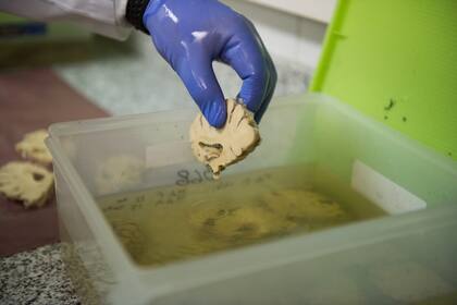 Una mitad del cerebro se conserva en formol y es la que se toma para analizar
