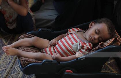 El bebé Abdul Rahman Abu Al-Jidyan, el primer niño infectado con polio en la Franja de Gaza.