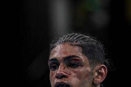 El boxeador Lucas Fernandez de Uruguay herido en el párpado