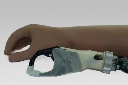 El brazo biónico myo-ARm, creado en Entre Ríos, es el primero en América latina
