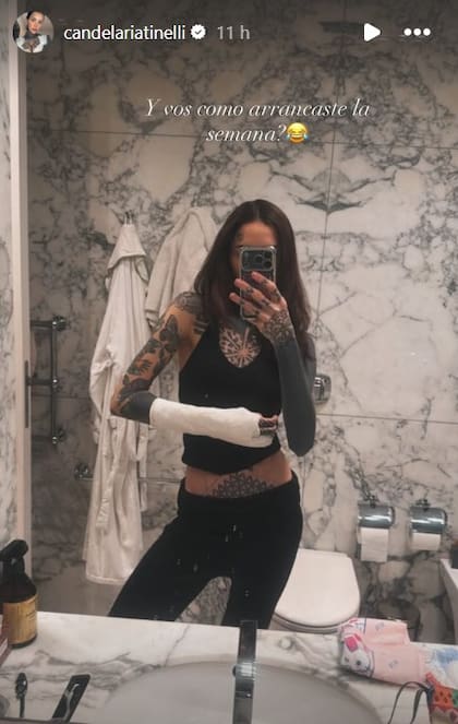 El brazo enyesado de Cande Tinelli