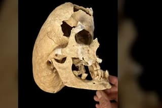 Encontraron un cráneo medieval y al estudiarlo se quedaron sin palabras: “Rara condición”