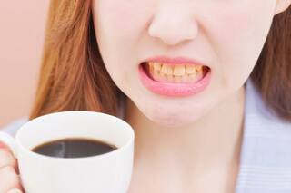 Cinco maneras de evitar que el café manche los dientes