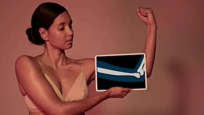 El calcio es solo uno de varios nutrientes esenciales para la salud de nuestros huesos