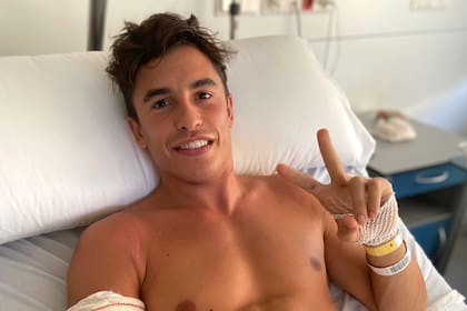 El campeón de MotoGP no perdió el buen ánimo; el cirujano apuntó que Márquez "en ningún momento ha sentido dolor" y "ha seguido siempre las indicaciones médicas y las sensaciones de su cuerpo".
