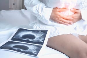 Una nueva terapia para casos avanzados abre expectativas para los pacientes