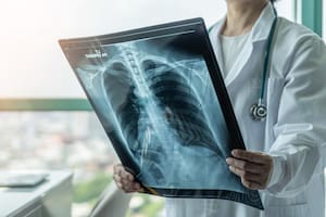 El cáncer de pulmón es el que más muertes genera en la Argentina