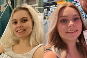 El cáncer es una enfermedad que cobra millones de vidas al año