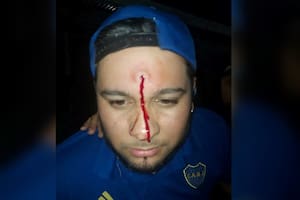 El cantante de cumbia "Yeison y el after", Esteban de Jesús Vallejos