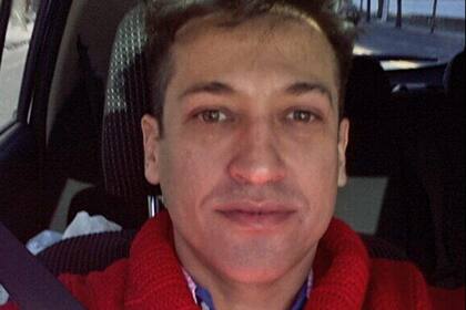 El cantante se quiso hacer algunos cambios estéticos...