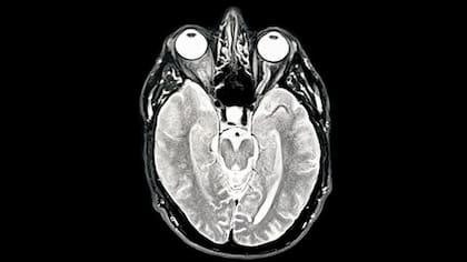 El cerebro cambia constantemente en respuesta a nuevos conocimientos.