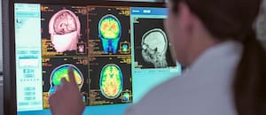 Descubren que un cerebro ansioso provoca la falta de un nutriente clave vinculado a la memoria