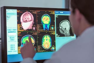 La adolescencia dura hasta los 30 años y cuáles son las otras edades clave para el cerebro