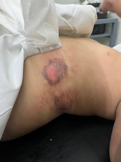 El chico sufrió politraumatismos