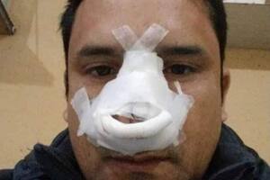 El chofer debió ser operado y se encuentra en reposo a raíz del golpe