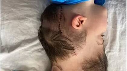 El cirujano Noor ul Owase Jeelani lo describió como "algo de la era espacial"