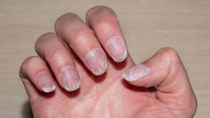El contacto con productos químicos puede causar uñas quebradizas
