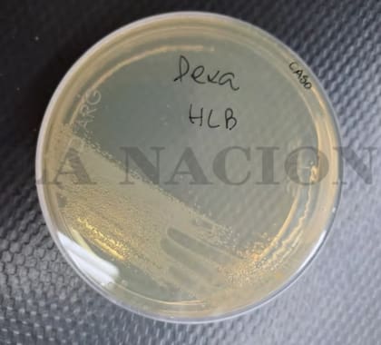 El cultivo de bacterias en la dexametasona de HLB
